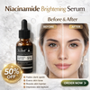 Teashell Niacinamide Brightening Serum |BUY ONE GET ONE FREE/ Fades Dark Spots, Evens Skin Tone & Boosts Glow