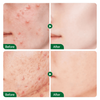 Teashell Niacinamide Brightening Serum |BUY ONE GET ONE FREE/ Fades Dark Spots, Evens Skin Tone & Boosts Glow